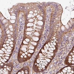 SOS2 Antibody, Novus Biologicals 0.1mL; Unlabeled:Antibodies, Polyclonal